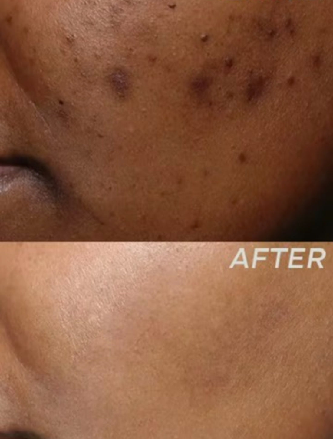 Skin Brightening Capsules