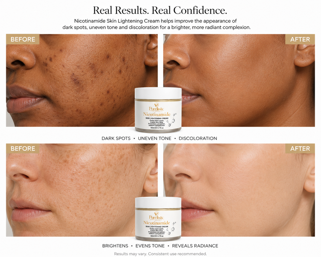 Skin Lightening Cream